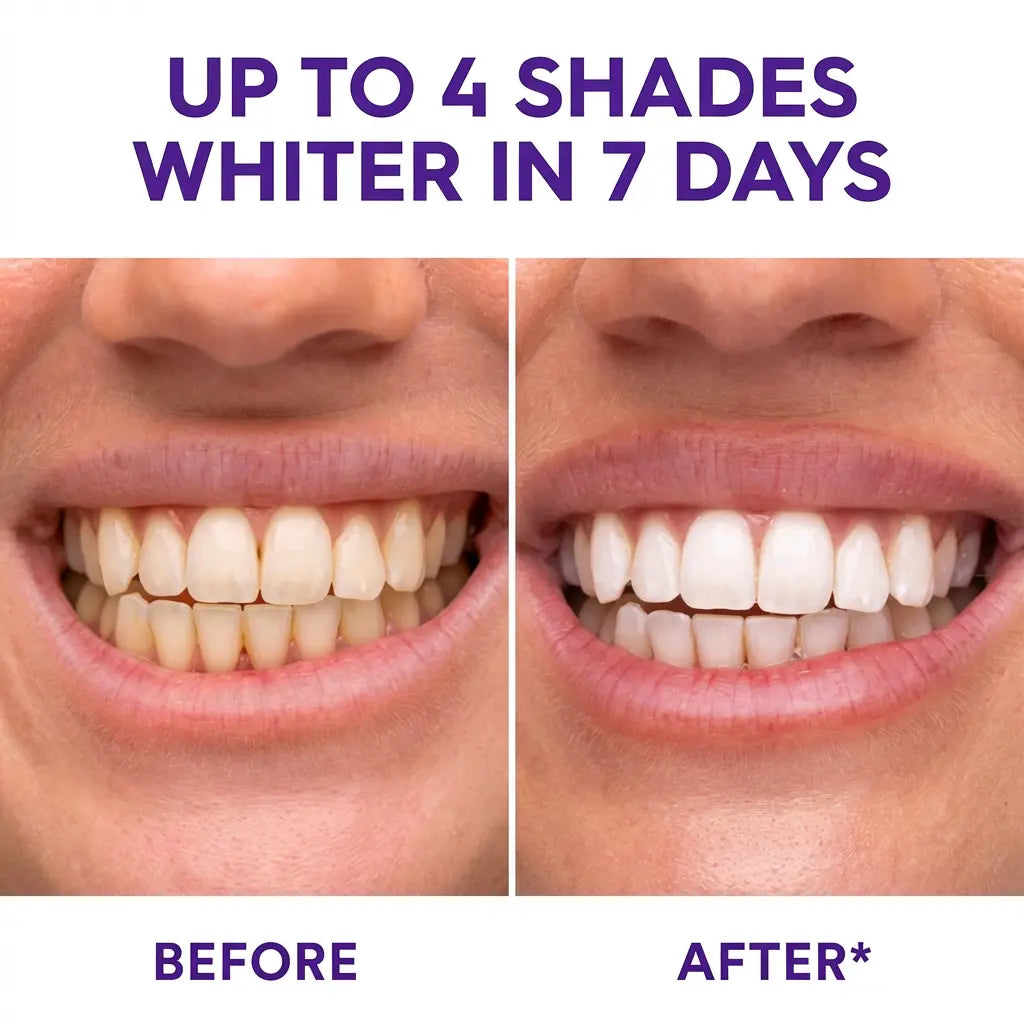 【Sakyproral】Purple Teeth Whitening Strip, 28 Strips, 7-Day Deep Whitening with Professional 6% Peroxide, No Residue, 4 Shades Whiter in 7 Days, Enamel Safe