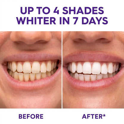 【Sakyproral】Purple Teeth Whitening Strip, 28 Strips, 7-Day Deep Whitening with Professional 6% Peroxide, No Residue, 4 Shades Whiter in 7 Days, Enamel Safe